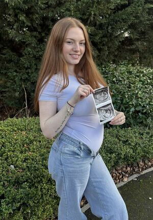 Alannah / Babylou17x / xali.lou