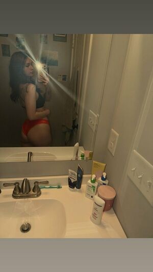 uronlyalysia