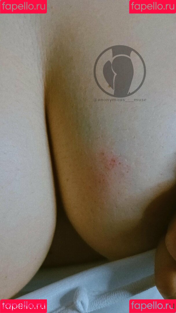 Anonymous___muse Onlyfans Photo Gallery 