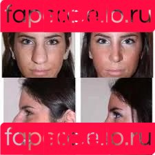 Kiara Peach Onlyfans Photo Gallery 