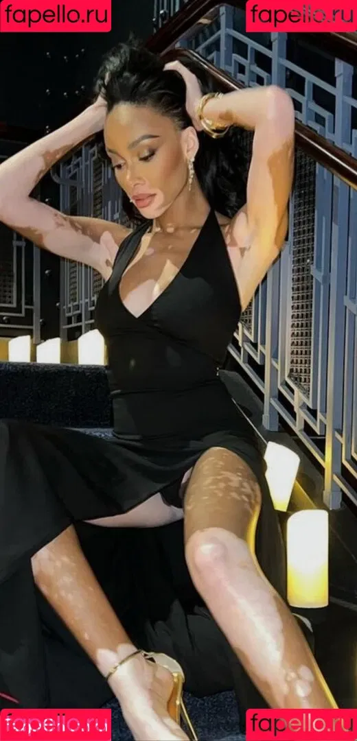 Winnie Harlow Onlyfans Photo Gallery 