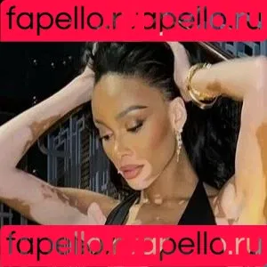 Winnie Harlow Onlyfans Photo Gallery 