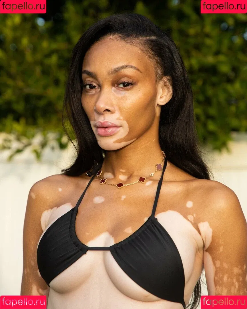 Winnie Harlow Onlyfans Photo Gallery 