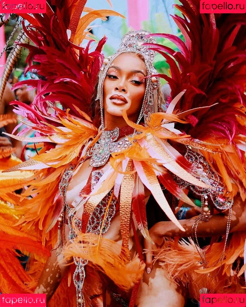 Winnie Harlow Onlyfans Photo Gallery 