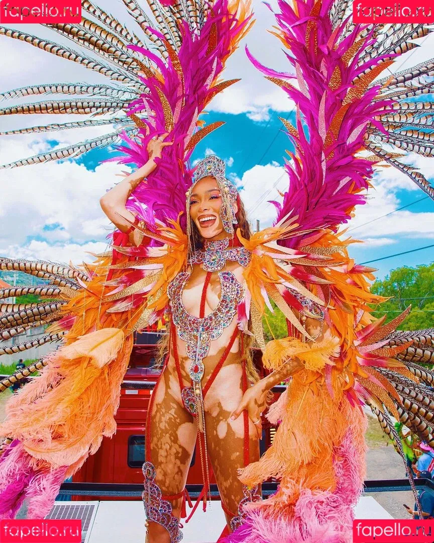 Winnie Harlow Onlyfans Photo Gallery 