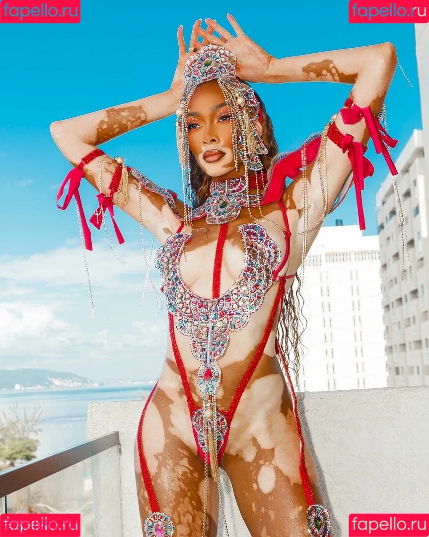 Winnie Harlow Onlyfans Photo Gallery 