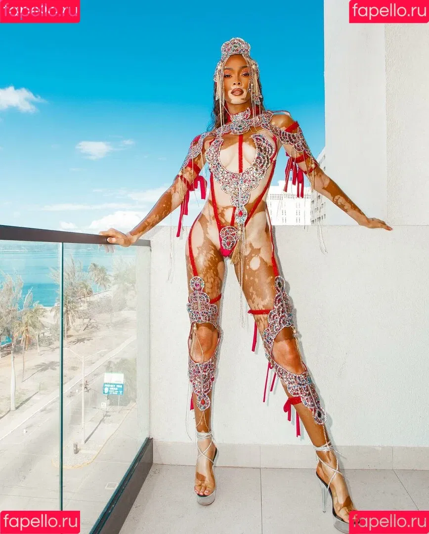 Winnie Harlow Onlyfans Photo Gallery 