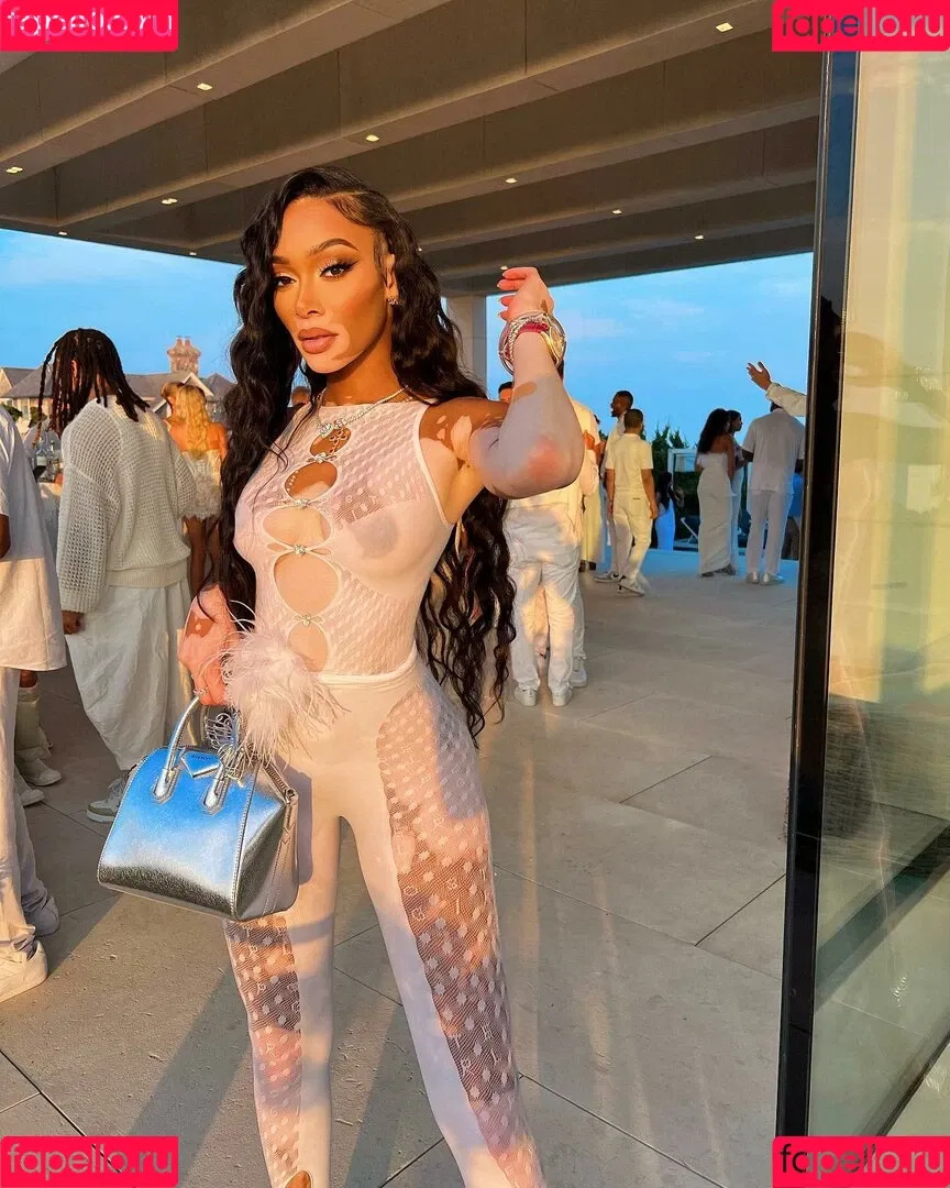 Winnie Harlow Onlyfans Photo Gallery 