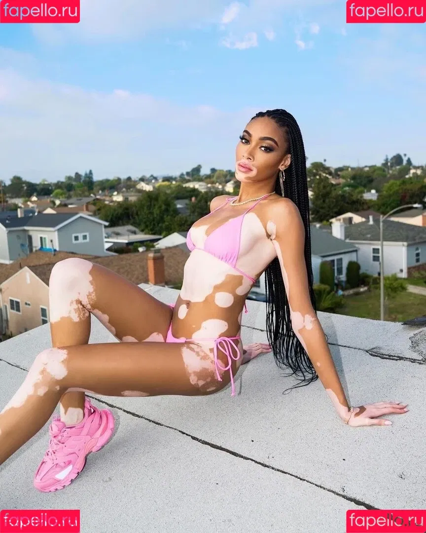 Winnie Harlow Onlyfans Photo Gallery 
