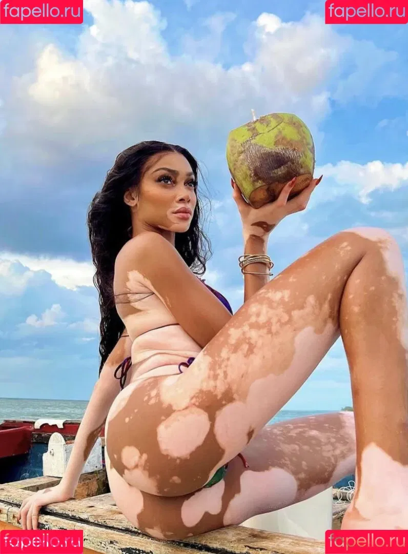 Winnie Harlow Onlyfans Photo Gallery 