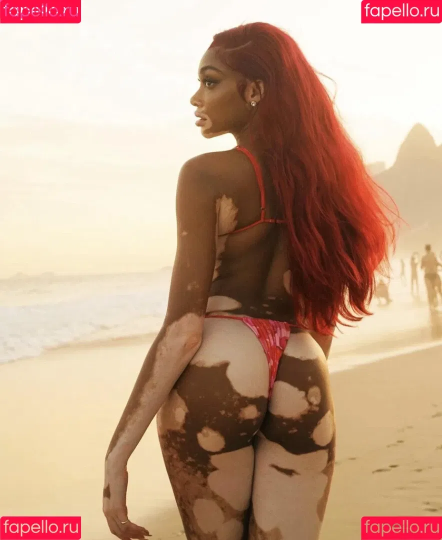 Winnie Harlow Onlyfans Photo Gallery 