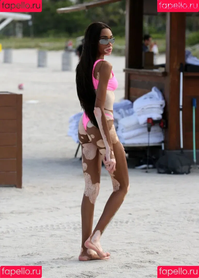 Winnie Harlow Onlyfans Photo Gallery 