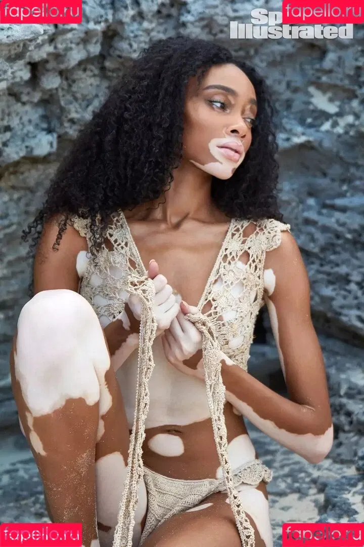 Winnie Harlow Onlyfans Photo Gallery 