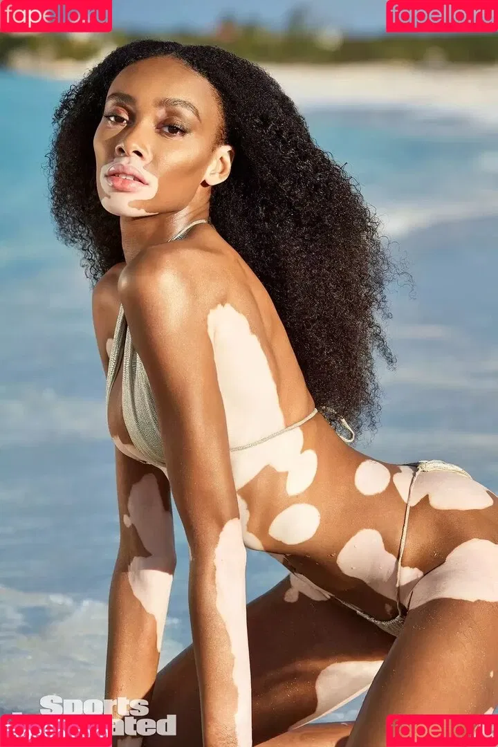 Winnie Harlow Onlyfans Photo Gallery 