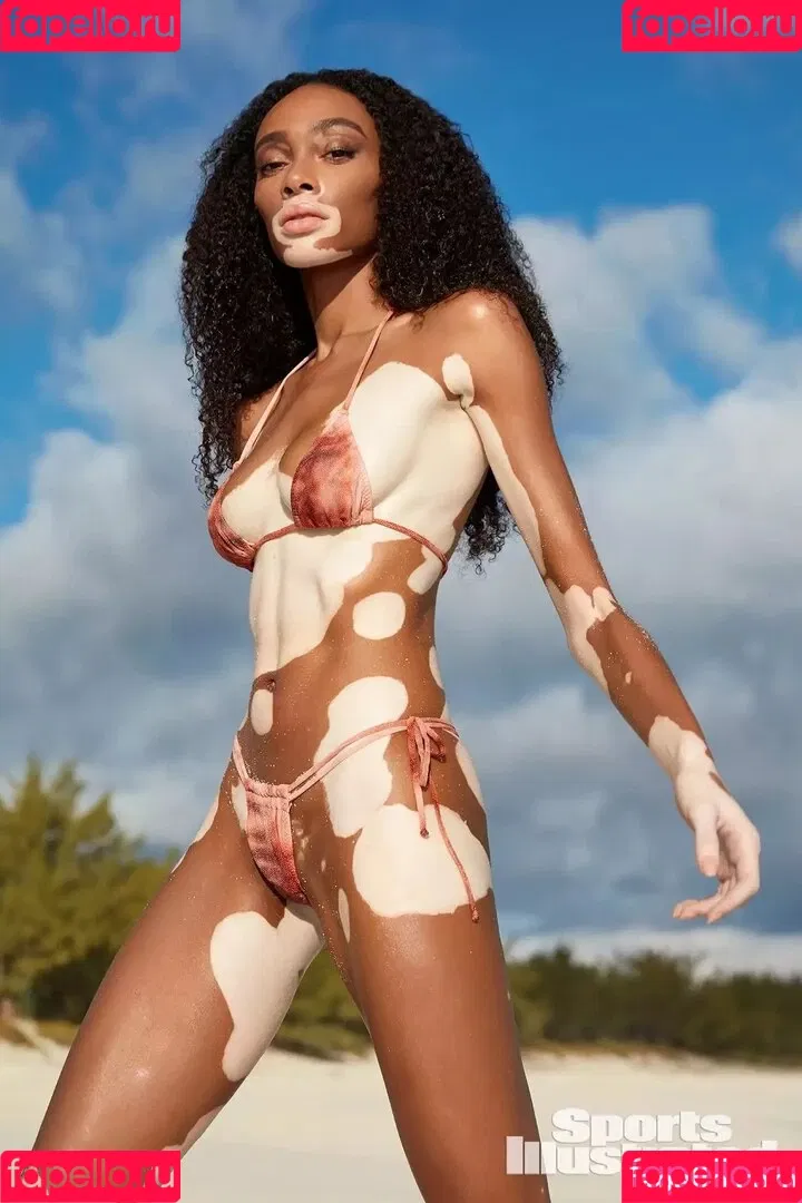 Winnie Harlow Onlyfans Photo Gallery 