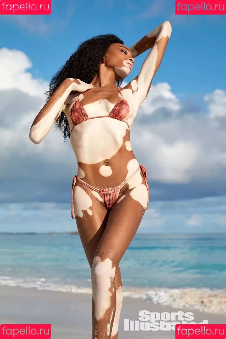Winnie Harlow Onlyfans Photo Gallery 