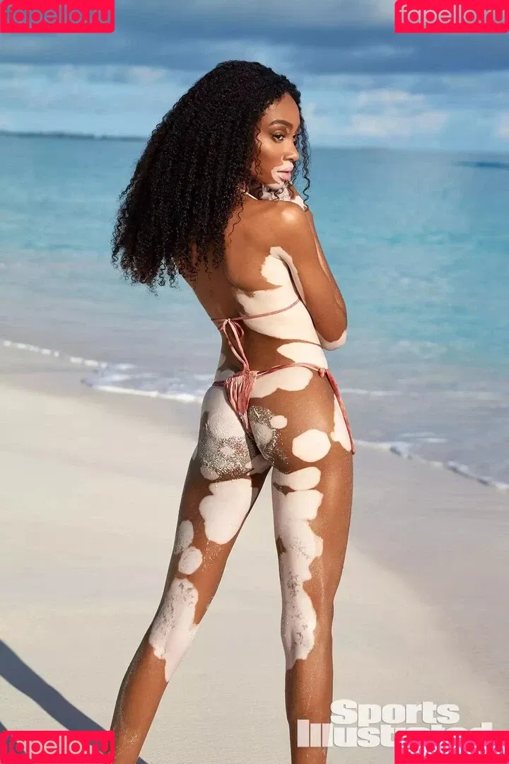 Winnie Harlow Onlyfans Photo Gallery 