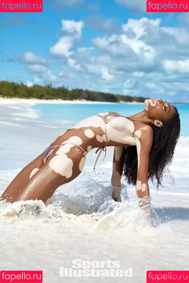 Winnie Harlow Onlyfans Photo Gallery 
