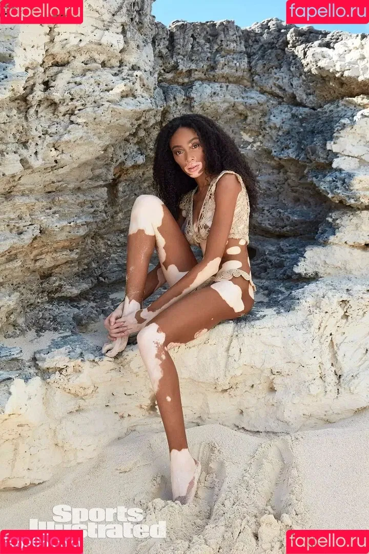 Winnie Harlow Onlyfans Photo Gallery 