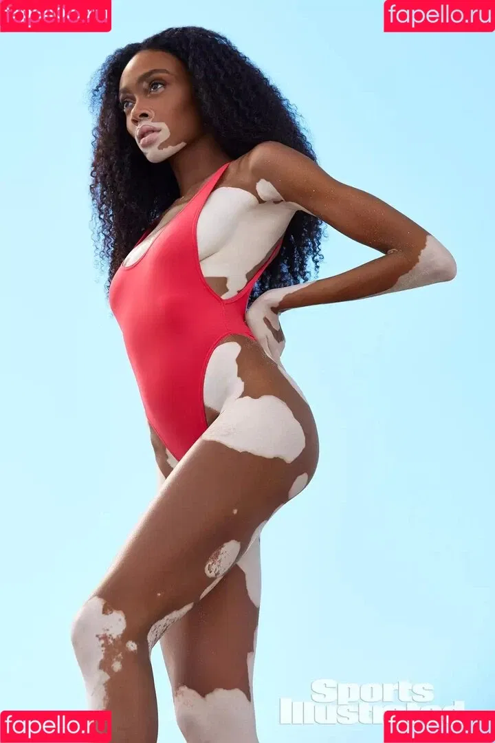 Winnie Harlow Onlyfans Photo Gallery 