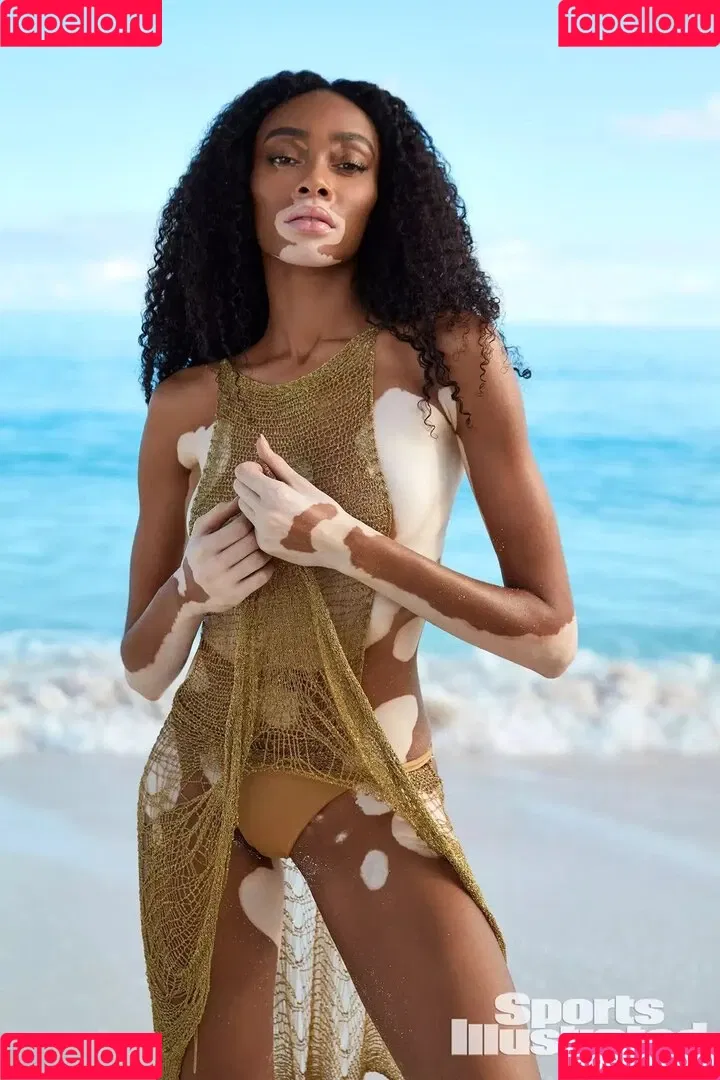 Winnie Harlow Onlyfans Photo Gallery 
