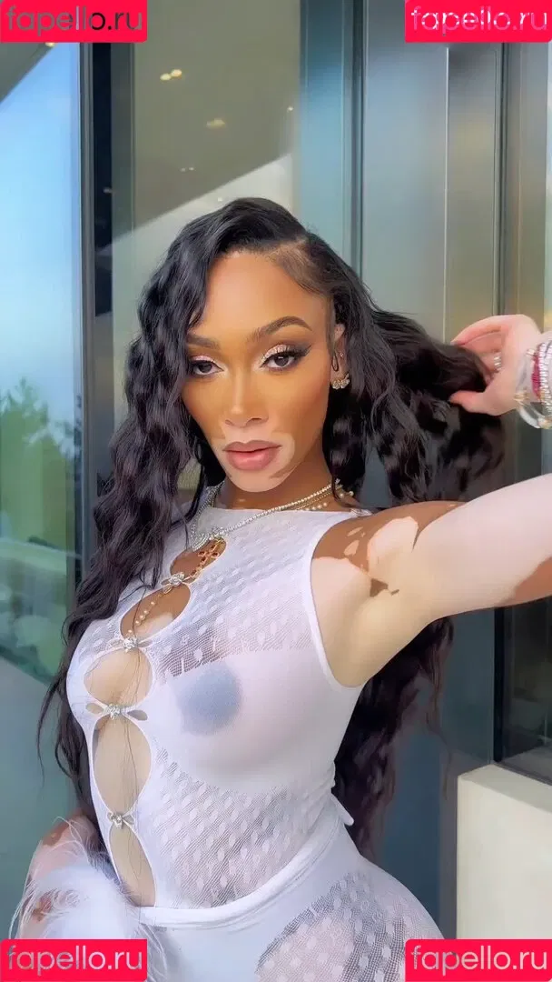 Winnie Harlow Onlyfans Photo Gallery 