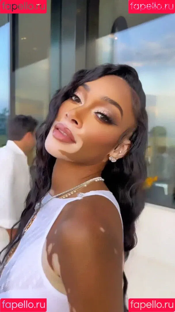 Winnie Harlow Onlyfans Photo Gallery 