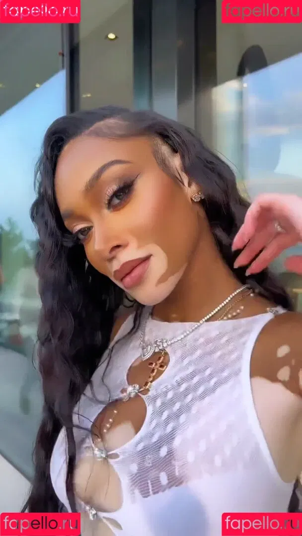 Winnie Harlow Onlyfans Photo Gallery 