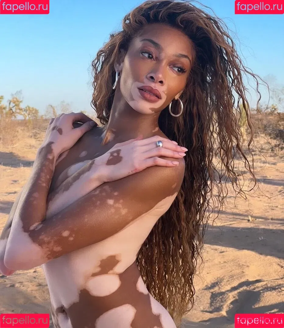 Winnie Harlow Onlyfans Photo Gallery 