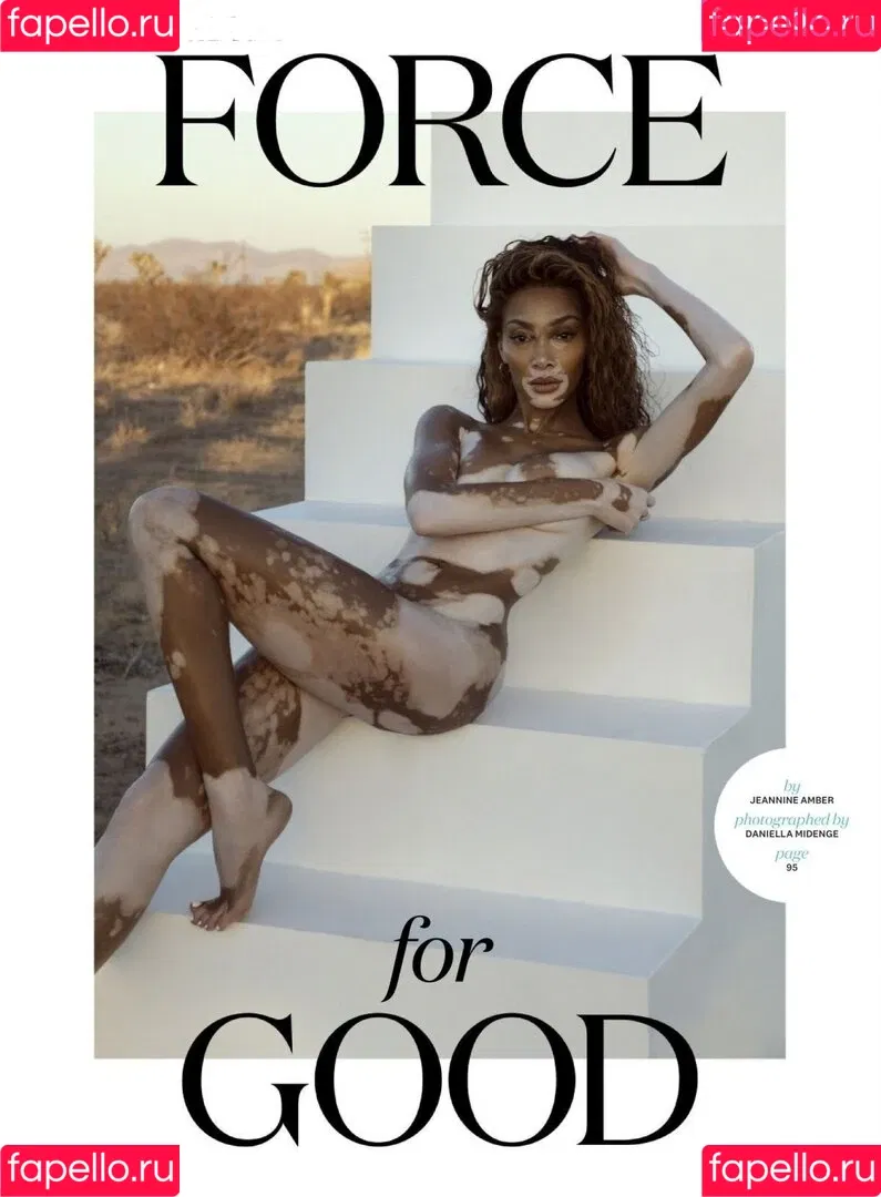 Winnie Harlow Onlyfans Photo Gallery 