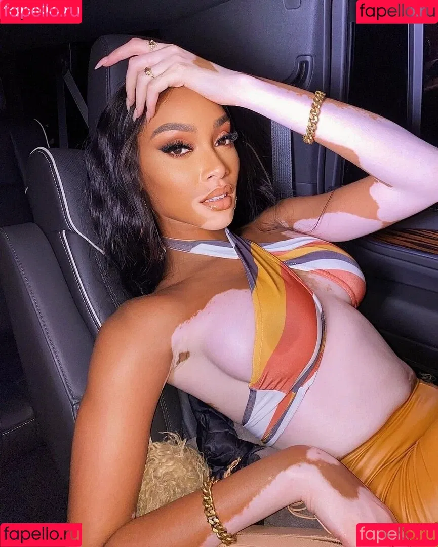 Winnie Harlow Onlyfans Photo Gallery 