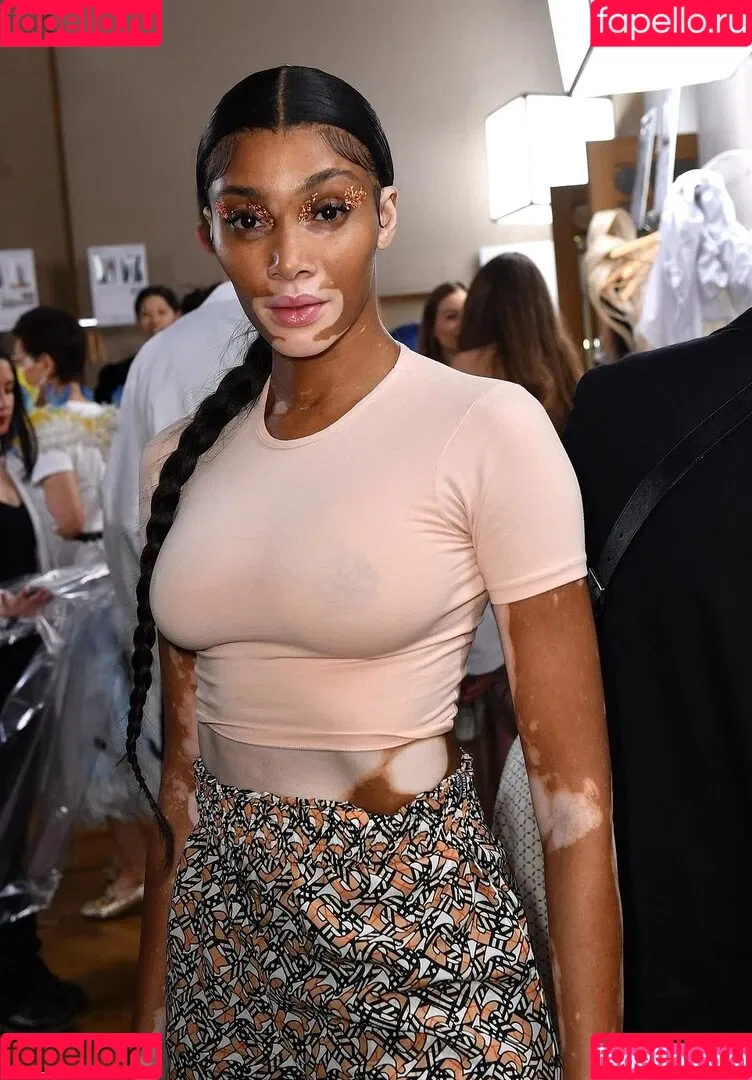 Winnie Harlow Onlyfans Photo Gallery 