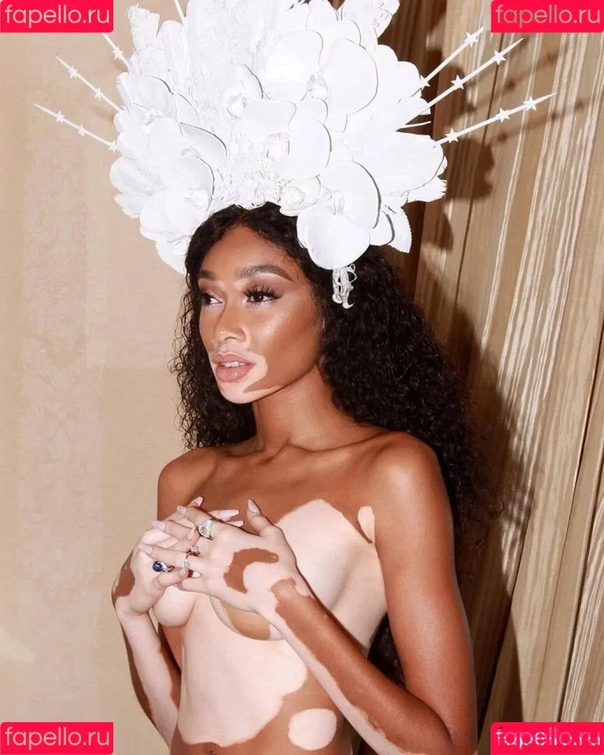 Winnie Harlow Onlyfans Photo Gallery 