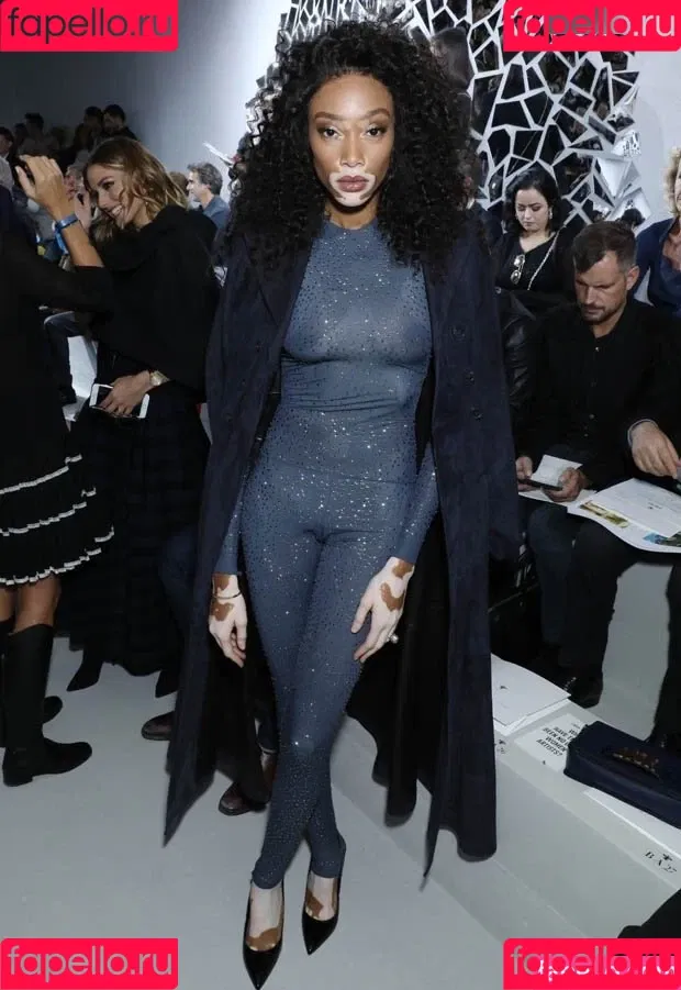 Winnie Harlow Onlyfans Photo Gallery 