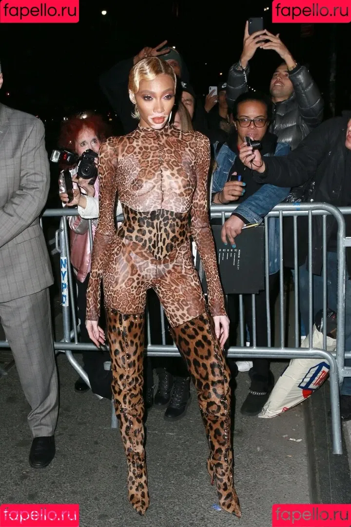 Winnie Harlow Onlyfans Photo Gallery 