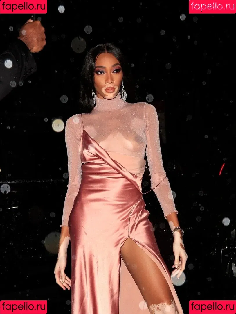 Winnie Harlow Onlyfans Photo Gallery 