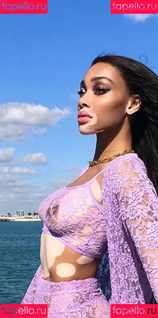 Winnie Harlow Onlyfans Photo Gallery 