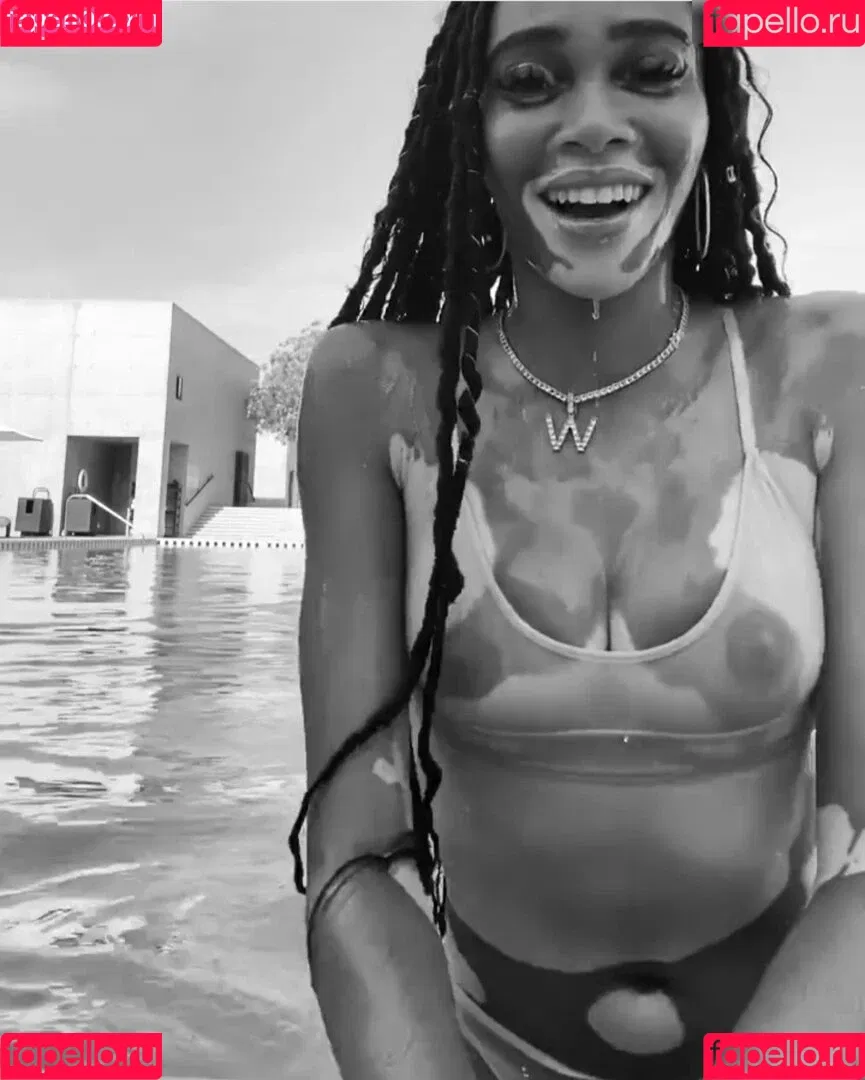 Winnie Harlow Onlyfans Photo Gallery 