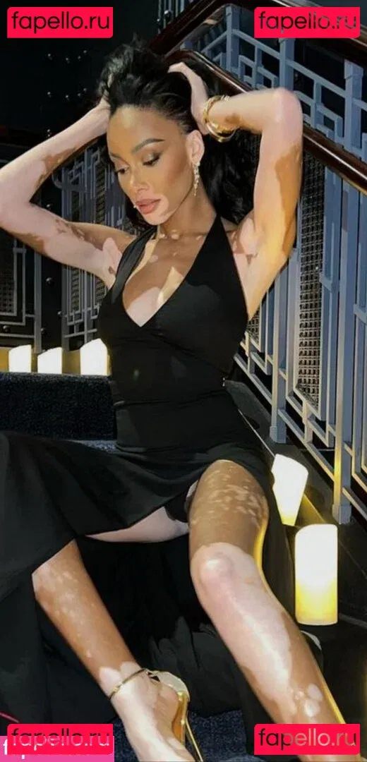 Winnie Harlow Onlyfans Photo Gallery 