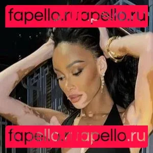 Winnie Harlow Onlyfans Photo Gallery 