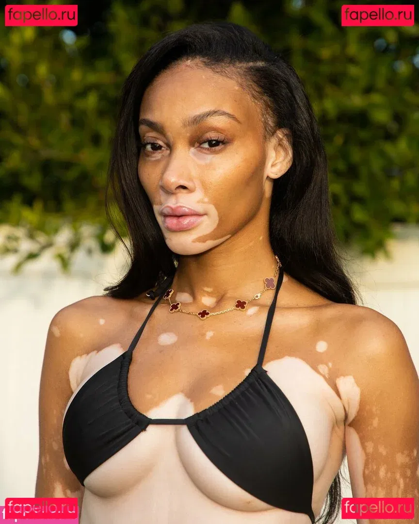 Winnie Harlow Onlyfans Photo Gallery 