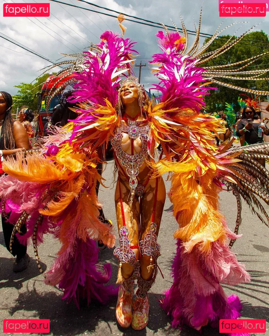 Winnie Harlow Onlyfans Photo Gallery 