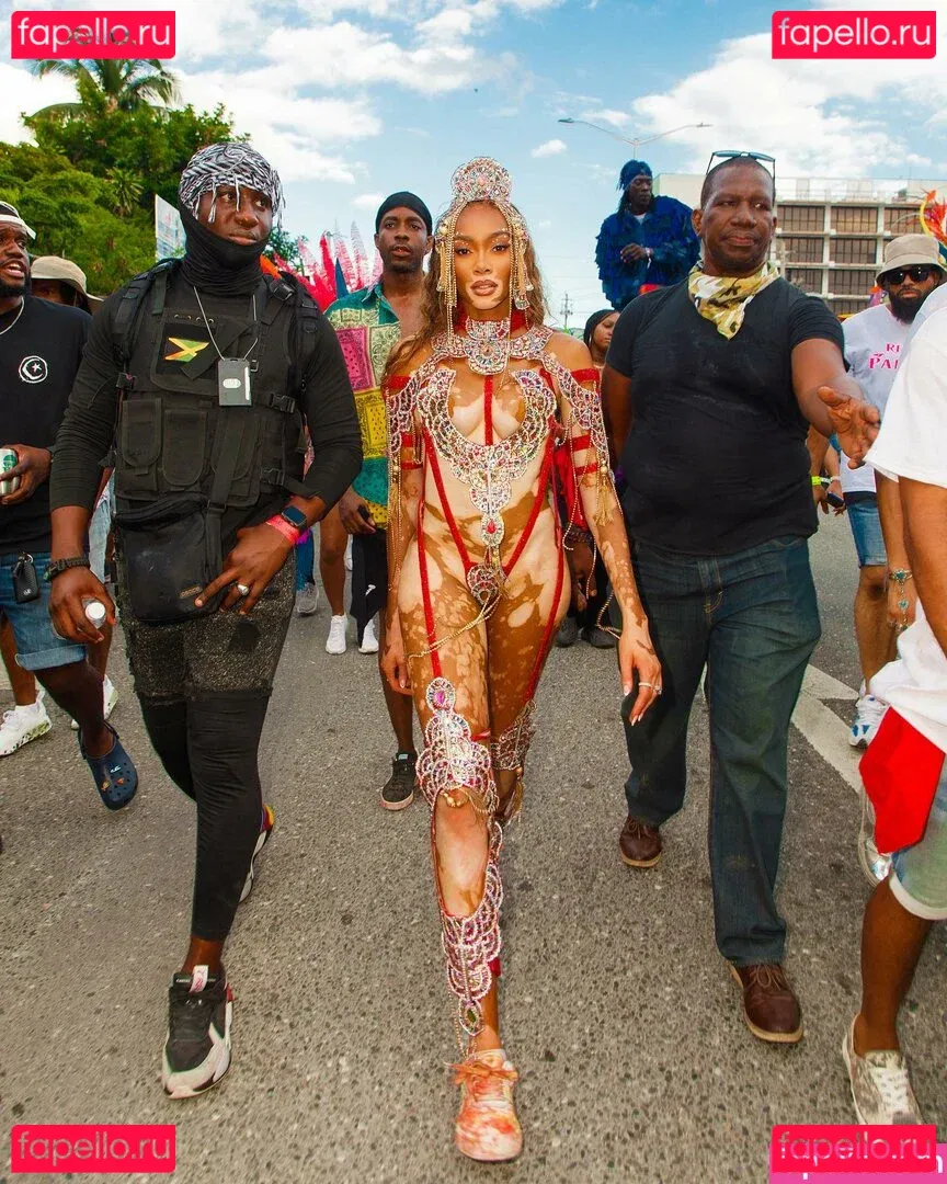 Winnie Harlow Onlyfans Photo Gallery 