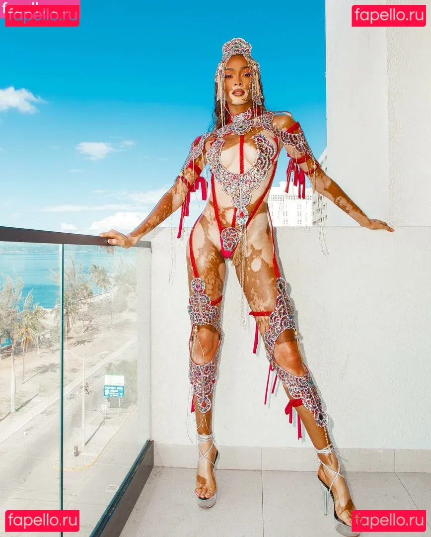 Winnie Harlow Onlyfans Photo Gallery 
