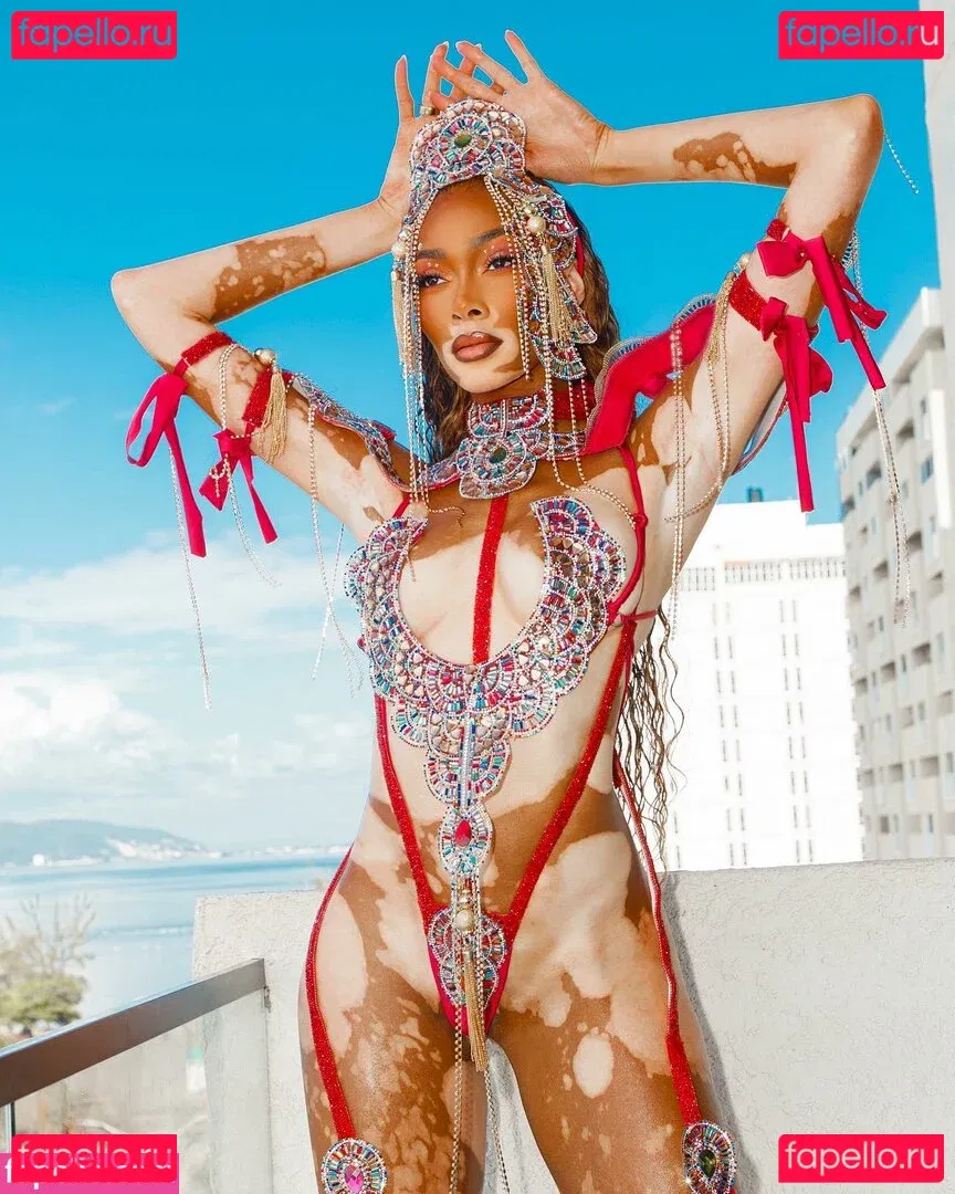 Winnie Harlow Onlyfans Photo Gallery 