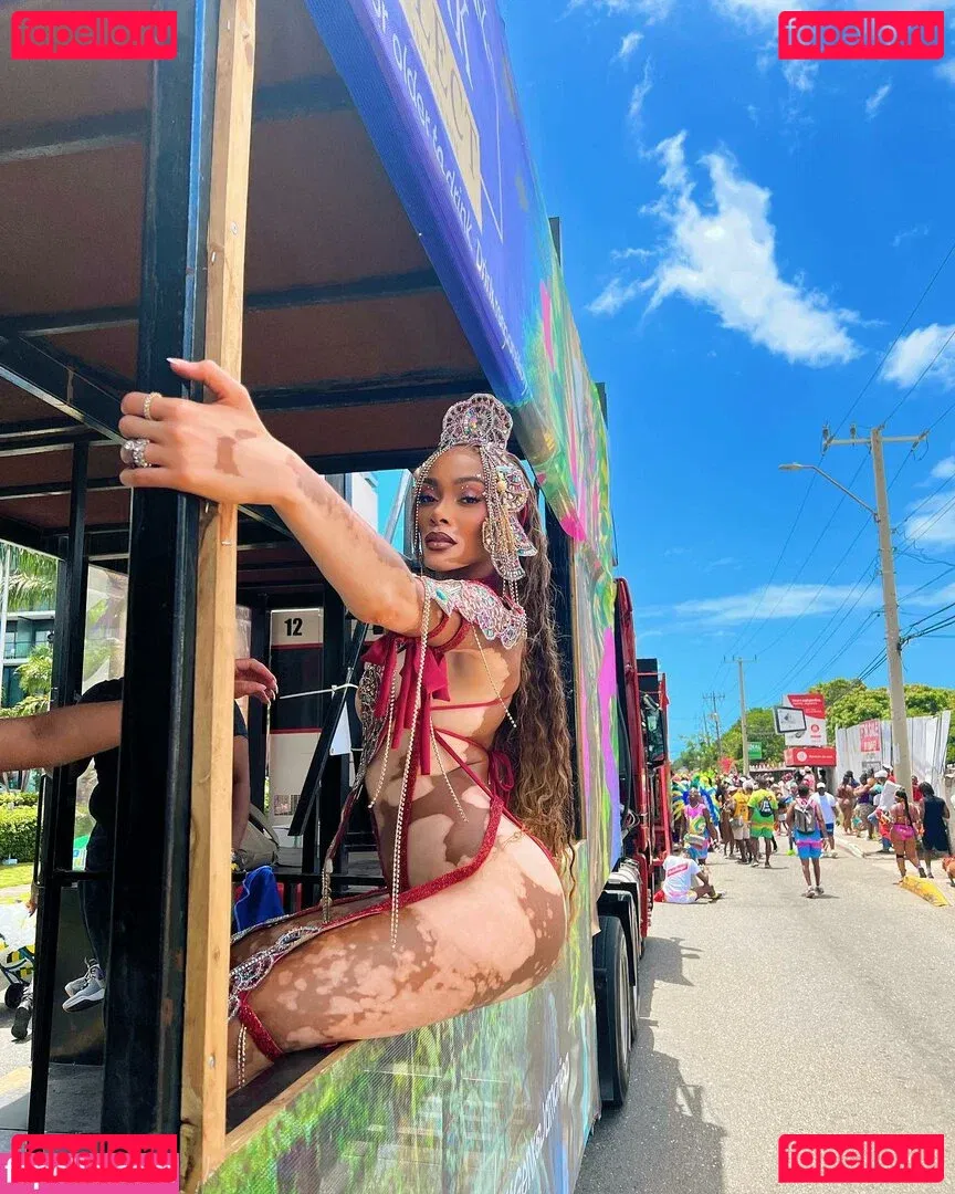 Winnie Harlow Onlyfans Photo Gallery 