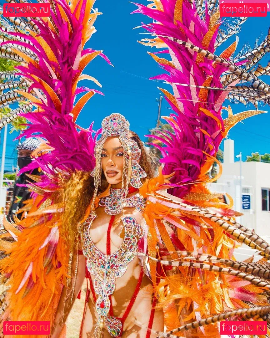 Winnie Harlow Onlyfans Photo Gallery 