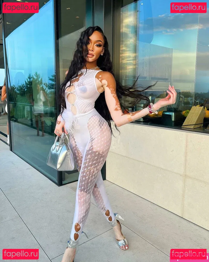 Winnie Harlow Onlyfans Photo Gallery 