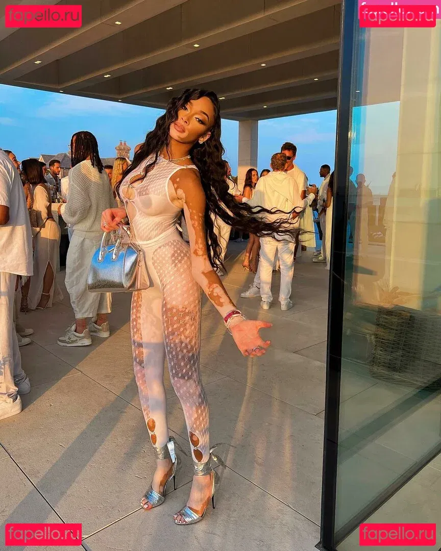 Winnie Harlow Onlyfans Photo Gallery 
