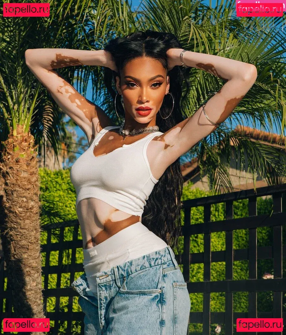 Winnie Harlow Onlyfans Photo Gallery 
